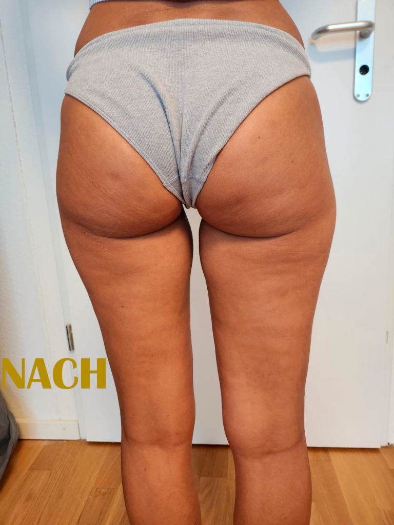 nach